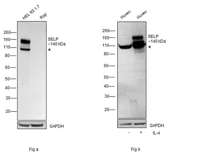 P-Selectin Antibody in Western Blot (WB)