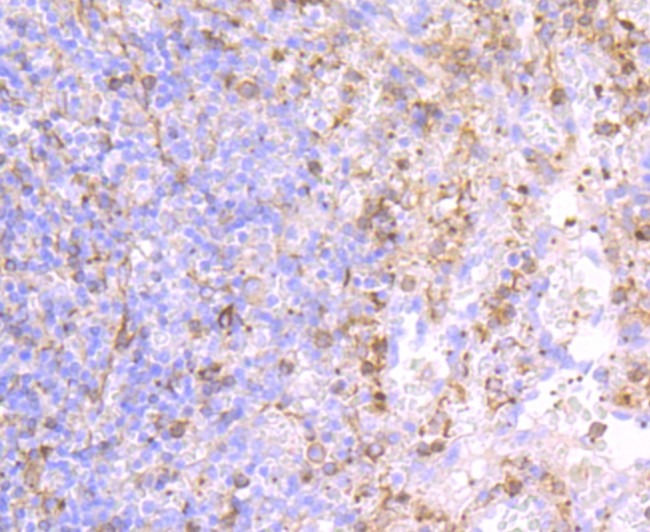 P-Selectin Antibody in Immunohistochemistry (Paraffin) (IHC (P))