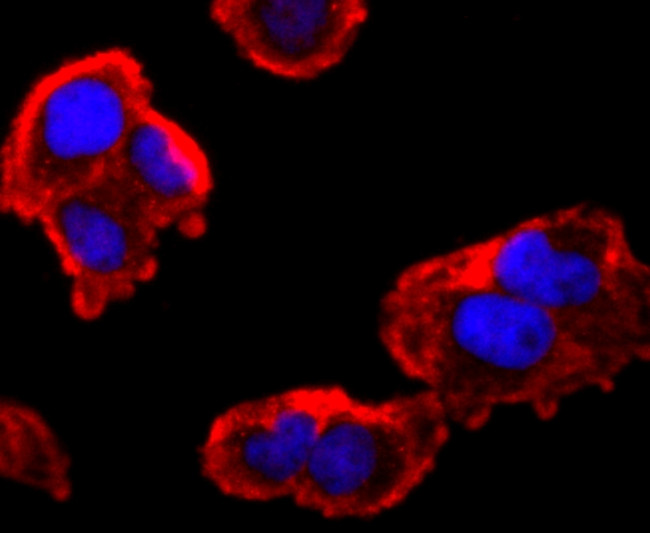 FMRP Antibody in Immunocytochemistry (ICC/IF)