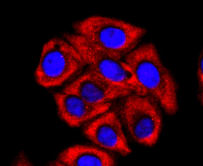 FMRP Antibody in Immunocytochemistry (ICC/IF)