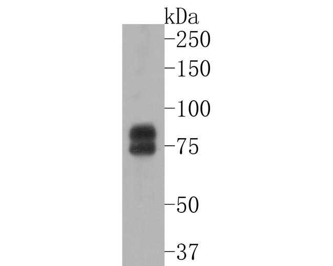 FMRP Antibody in Western Blot (WB)