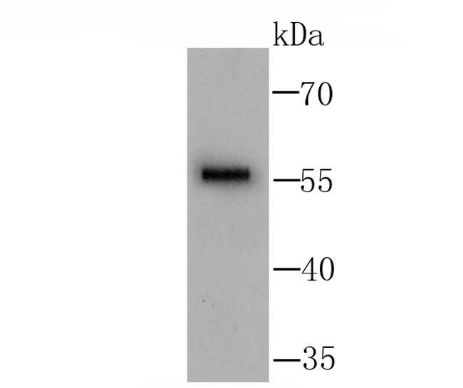 GLAST Antibody in Western Blot (WB)