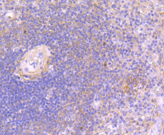 JAK3 Antibody in Immunohistochemistry (Paraffin) (IHC (P))