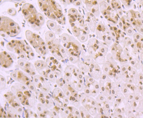 TAK1 Antibody in Immunohistochemistry (Paraffin) (IHC (P))