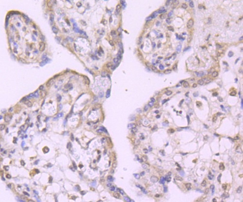 TAK1 Antibody in Immunohistochemistry (Paraffin) (IHC (P))