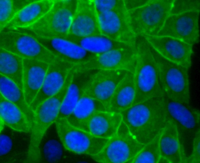 Placental Alkaline Phosphatase Antibody in Immunocytochemistry (ICC/IF)