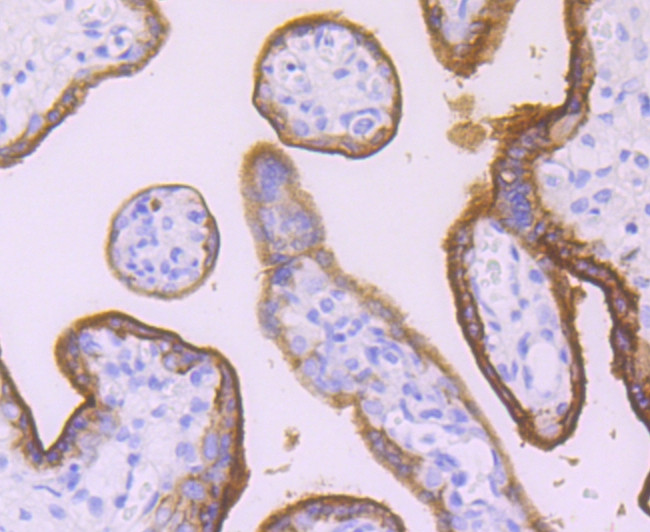 Placental Alkaline Phosphatase Antibody in Immunohistochemistry (Paraffin) (IHC (P))