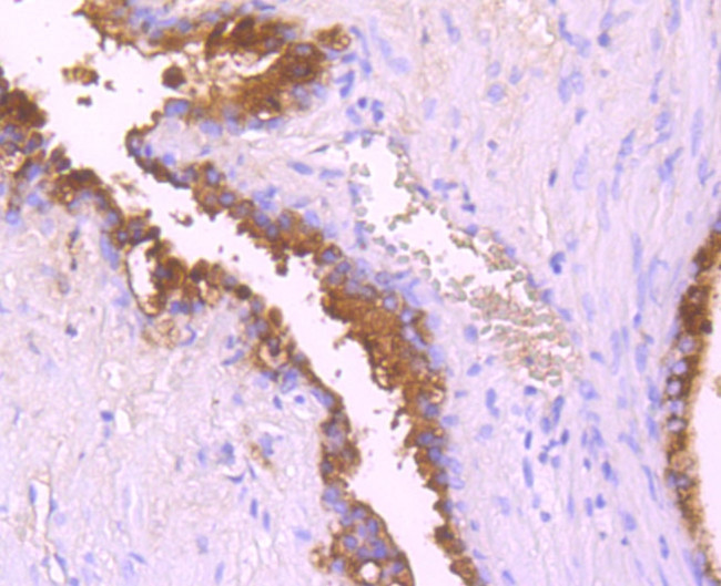 SERPINA3 Antibody in Immunohistochemistry (Paraffin) (IHC (P))