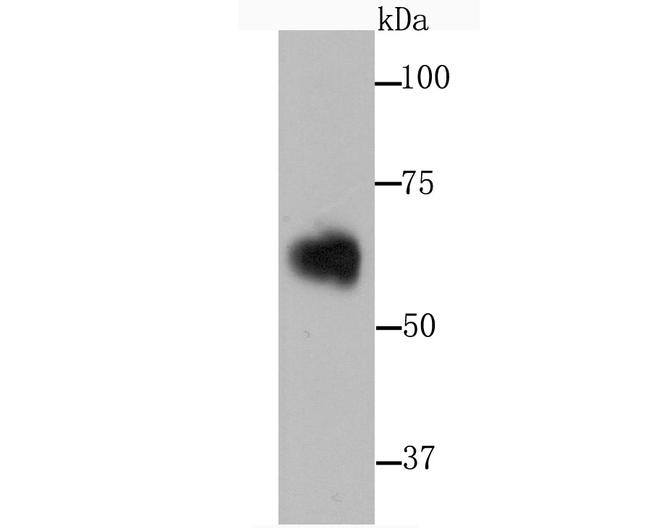 SERPINA3 Antibody in Western Blot (WB)