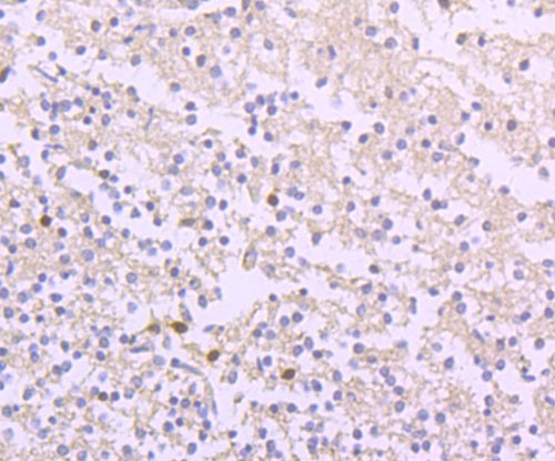 Ferritin Heavy Chain Antibody in Immunohistochemistry (Paraffin) (IHC (P))