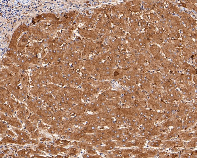 Ferritin Heavy Chain Antibody in Immunohistochemistry (Paraffin) (IHC (P))