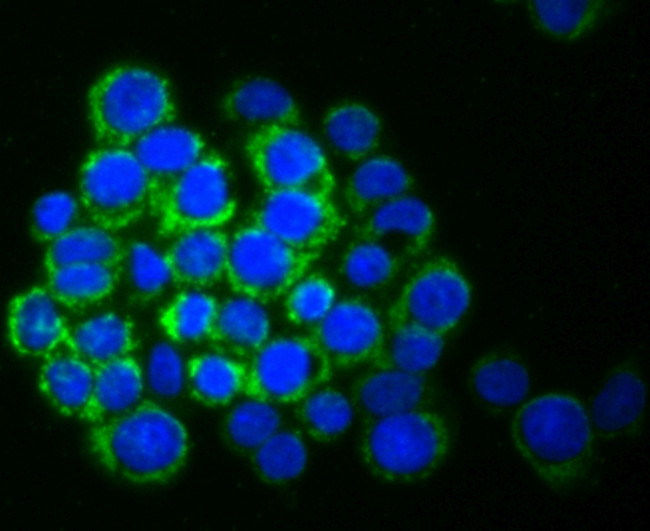 SMYD3 Antibody in Immunocytochemistry (ICC/IF)