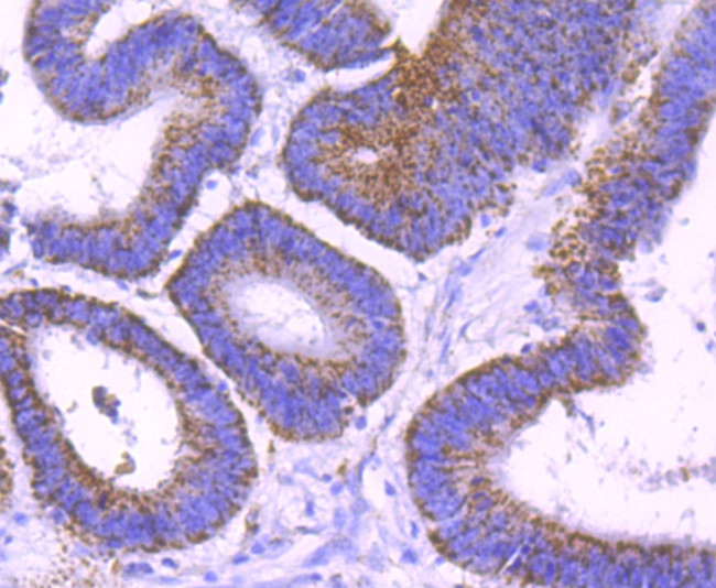 SMYD3 Antibody in Immunohistochemistry (Paraffin) (IHC (P))