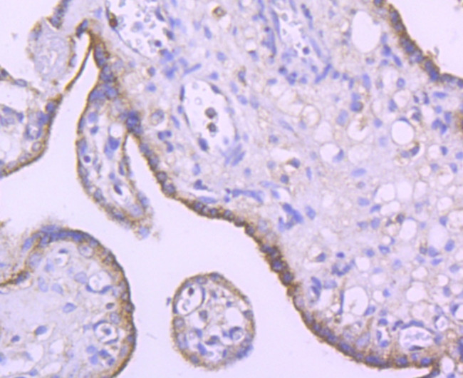 SMYD3 Antibody in Immunohistochemistry (Paraffin) (IHC (P))