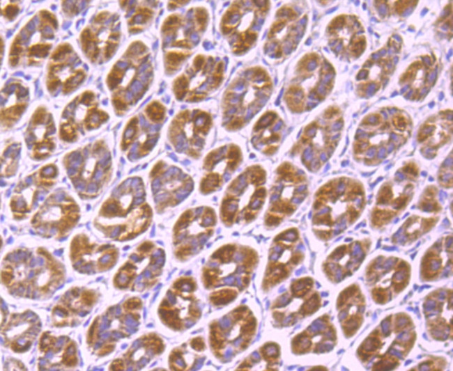 SMYD3 Antibody in Immunohistochemistry (Paraffin) (IHC (P))