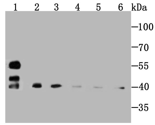 SMYD3 Antibody in Western Blot (WB)