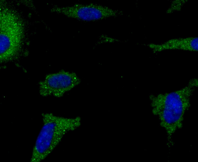 IBA1 Antibody in Immunocytochemistry (ICC/IF)