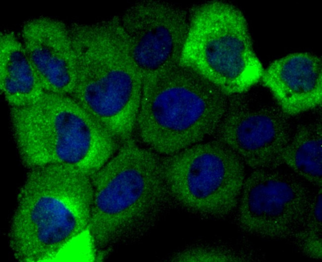 Aldolase A Antibody in Immunocytochemistry (ICC/IF)