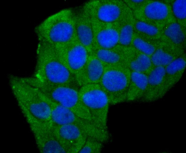 Aldolase A Antibody in Immunocytochemistry (ICC/IF)