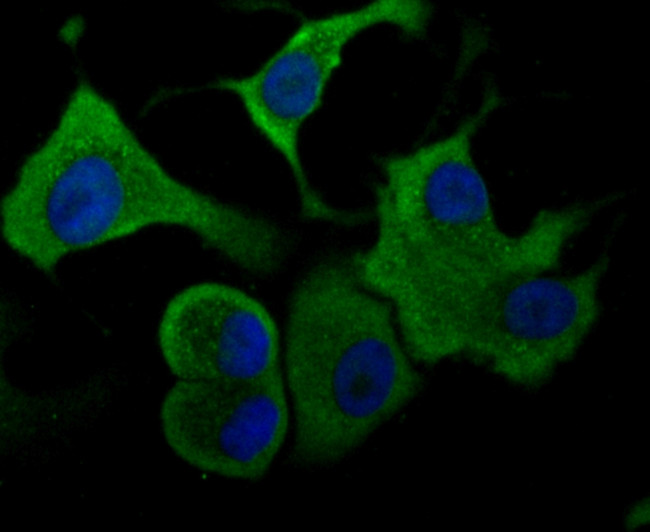 Aldolase A Antibody in Immunocytochemistry (ICC/IF)