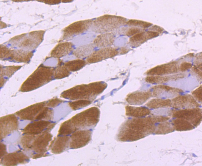 Aldolase A Antibody in Immunohistochemistry (Paraffin) (IHC (P))