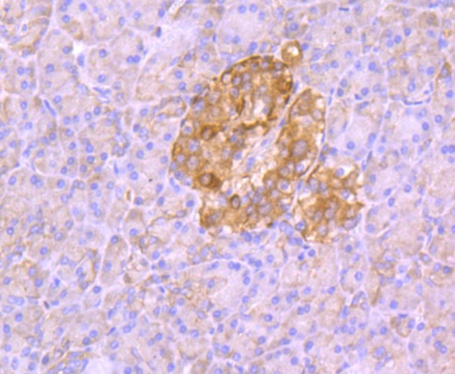 Aldolase A Antibody in Immunohistochemistry (Paraffin) (IHC (P))