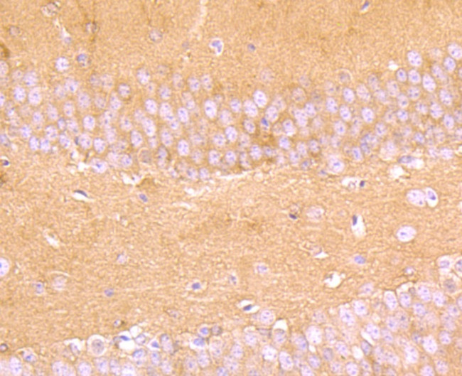 Aldolase A Antibody in Immunohistochemistry (Paraffin) (IHC (P))