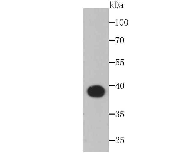 Aldolase A Antibody in Western Blot (WB)