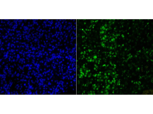 Histone H2A.X Antibody in Immunohistochemistry (Paraffin) (IHC (P))