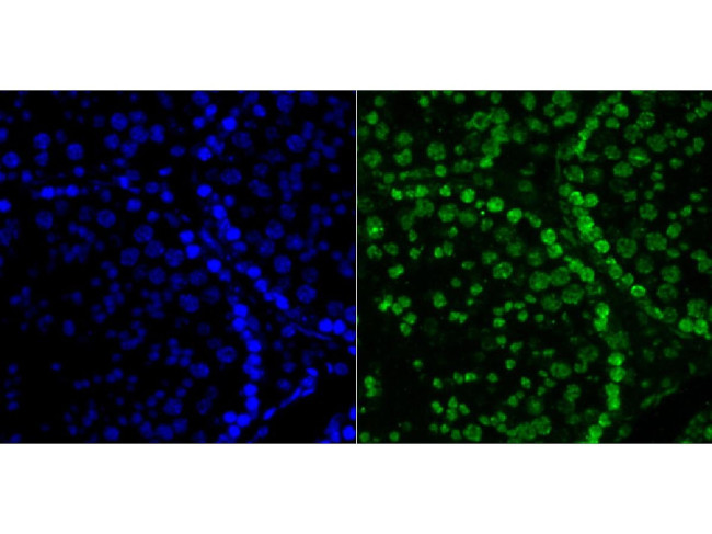 Histone H2A.X Antibody in Immunohistochemistry (Paraffin) (IHC (P))