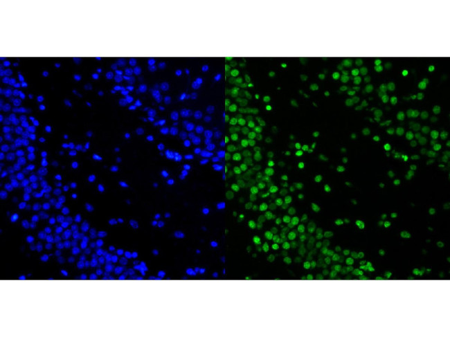 Histone H2A.X Antibody in Immunohistochemistry (Paraffin) (IHC (P))