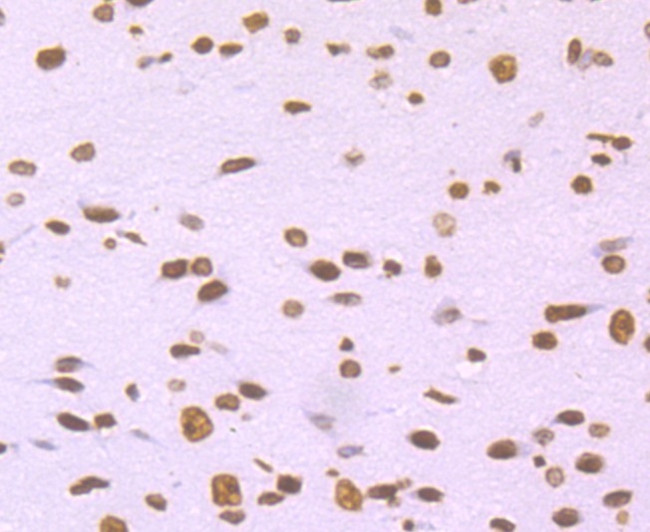 Histone H2A.X Antibody in Immunohistochemistry (Paraffin) (IHC (P))