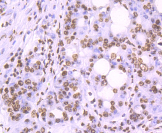 Histone H2A.X Antibody in Immunohistochemistry (Paraffin) (IHC (P))