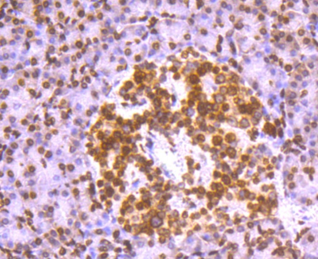 Histone H2A.X Antibody in Immunohistochemistry (Paraffin) (IHC (P))