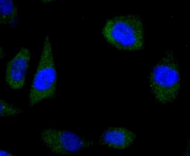 WNT5A Antibody in Immunocytochemistry (ICC/IF)