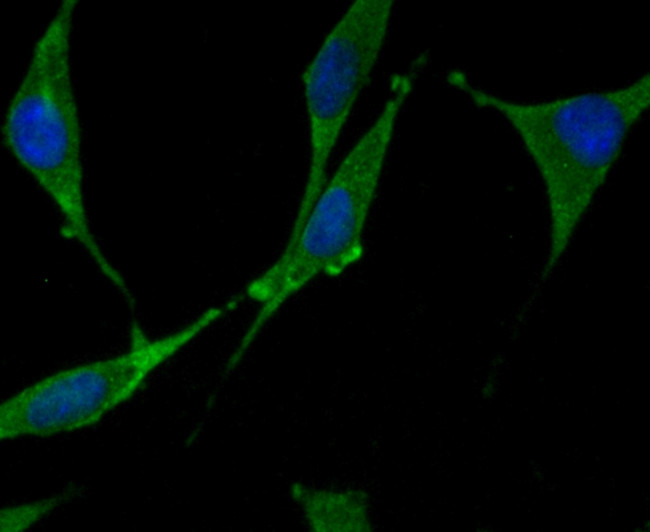 N-WASP Antibody in Immunocytochemistry (ICC/IF)