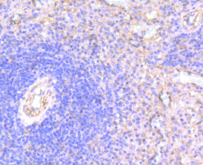 N-WASP Antibody in Immunohistochemistry (Paraffin) (IHC (P))