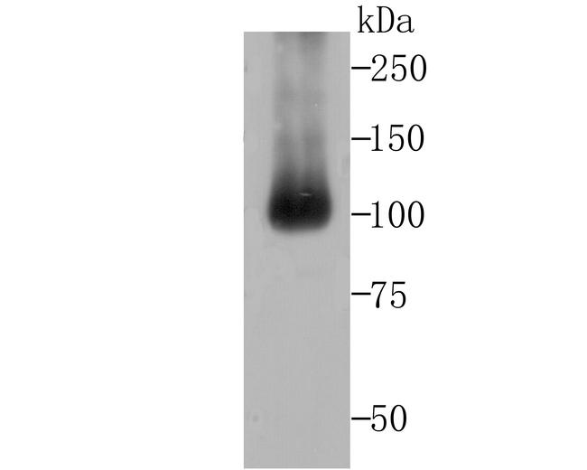 ALDH1L1 Antibody in Western Blot (WB)