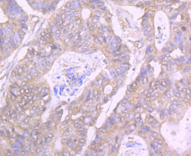 GIT1 Antibody in Immunohistochemistry (Paraffin) (IHC (P))