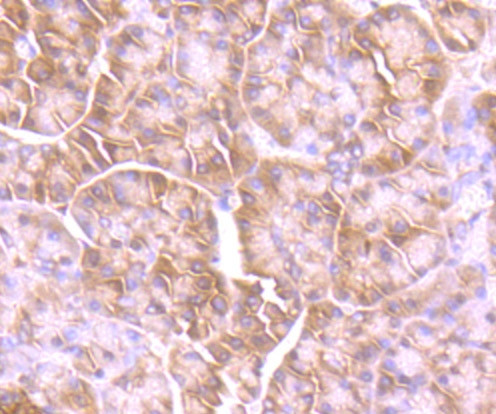 GIT1 Antibody in Immunohistochemistry (Paraffin) (IHC (P))