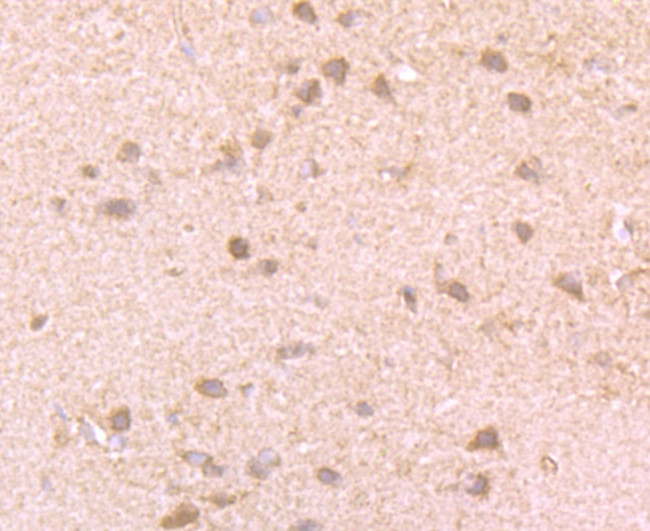 GIT1 Antibody in Immunohistochemistry (Paraffin) (IHC (P))