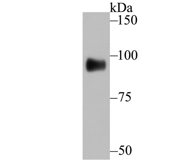 GIT1 Antibody in Western Blot (WB)