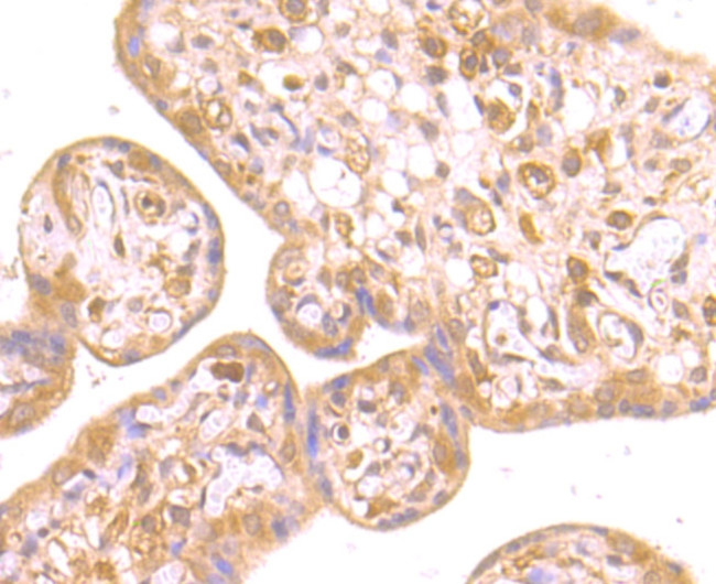 RNF2 Antibody in Immunohistochemistry (Paraffin) (IHC (P))