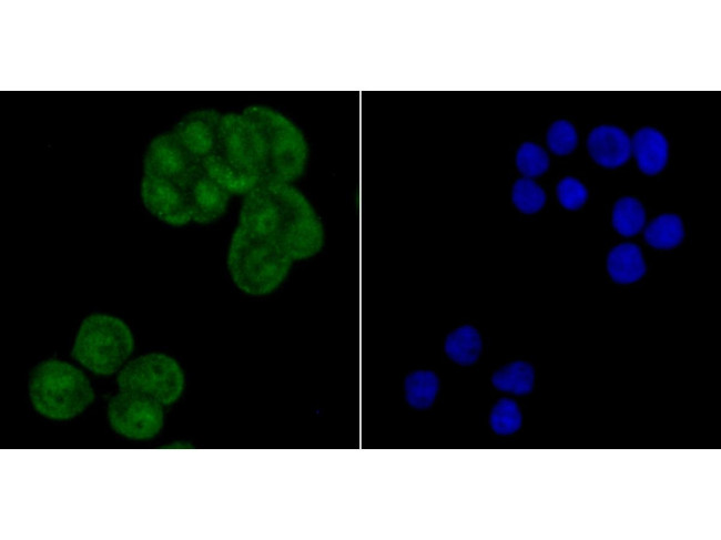 CRM1 Antibody in Immunocytochemistry (ICC/IF)