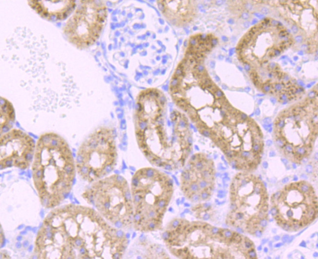 PCK2 Antibody in Immunohistochemistry (Paraffin) (IHC (P))