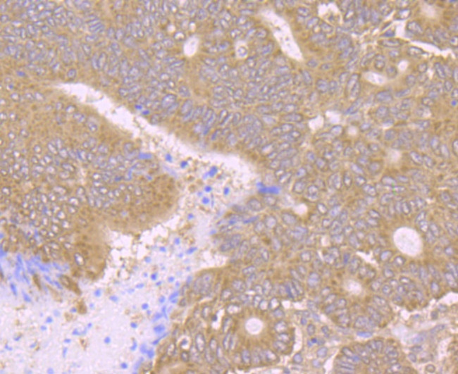 PCK2 Antibody in Immunohistochemistry (Paraffin) (IHC (P))