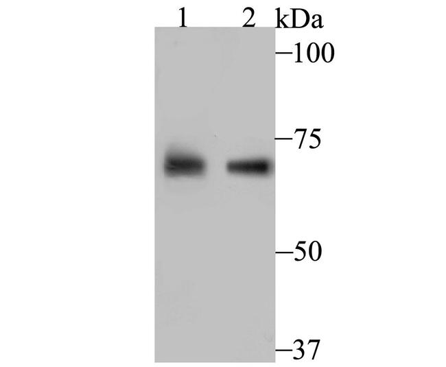 PCK2 Antibody in Western Blot (WB)