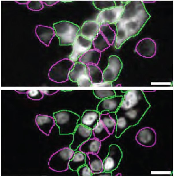 Huntingtin Antibody in Immunocytochemistry (ICC/IF)