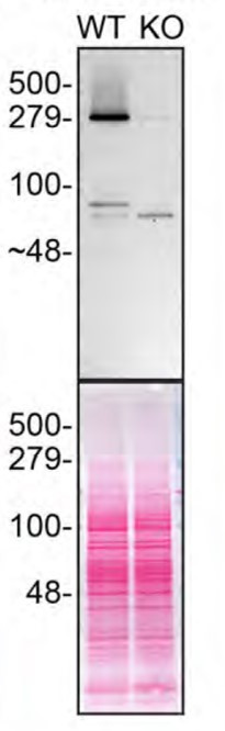 Huntingtin Antibody in Western Blot (WB)