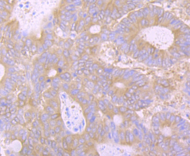 Huntingtin Antibody in Immunohistochemistry (Paraffin) (IHC (P))